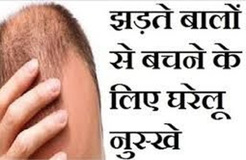 These home remedies will grow hair on bald head in a few days.