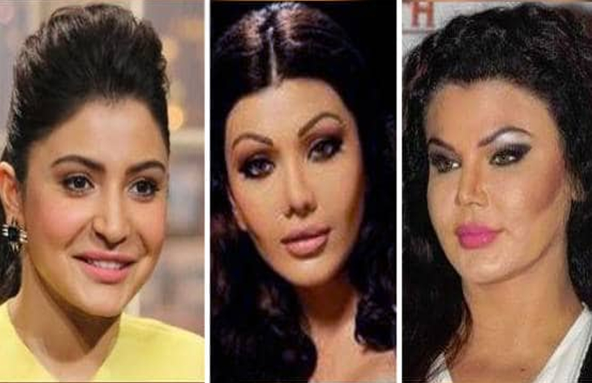 Actresses whose trolled for wrong plastic surgery