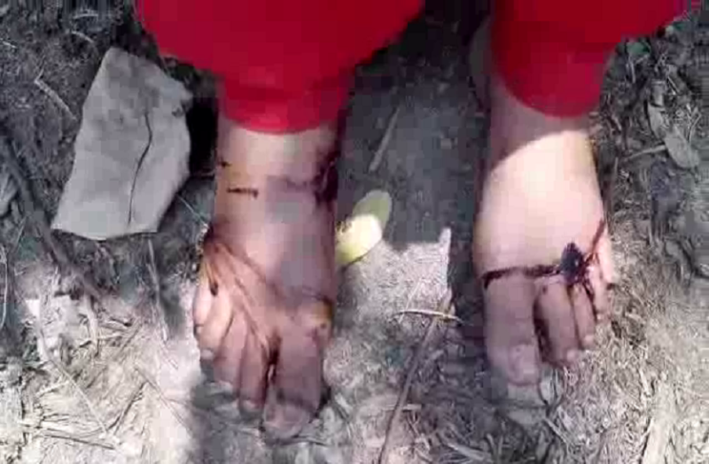 Daughter's feet crushed with a hammer Could not go to the lover