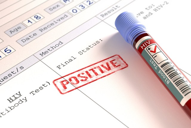 HIV Positive test
