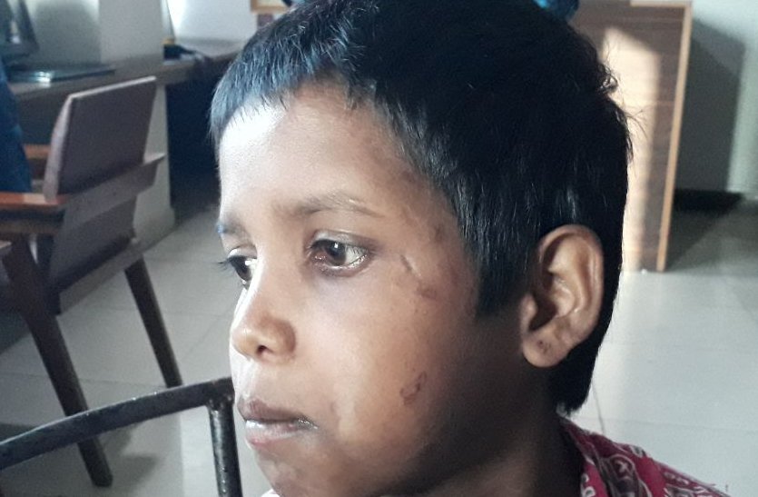 child became labor, tortured by the shopkeeper