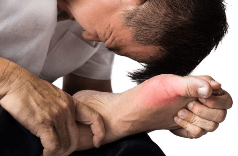gout-arthritis-symptoms-and-treatment