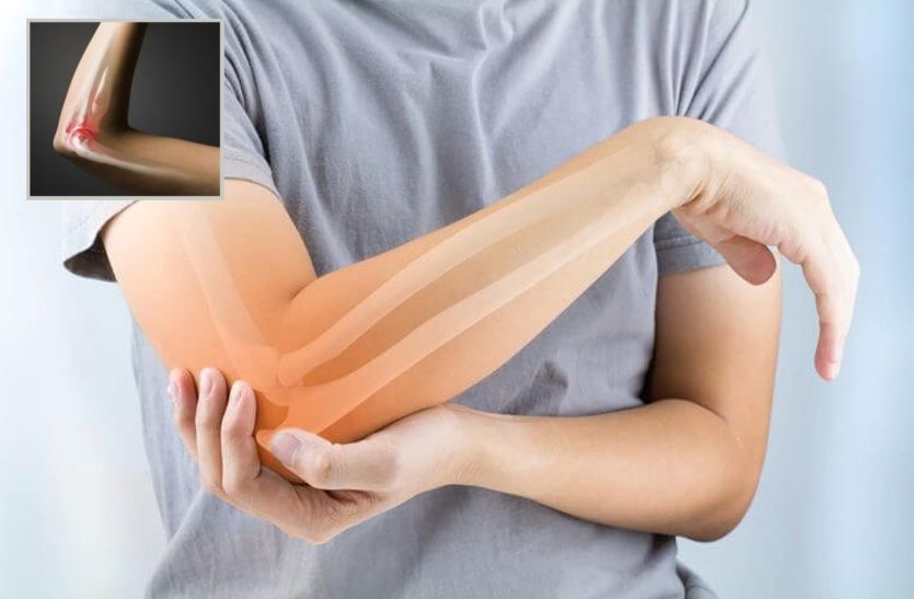 bone-cancer-learn-about-bone-cancers-reasons-symptoms-and-treatment