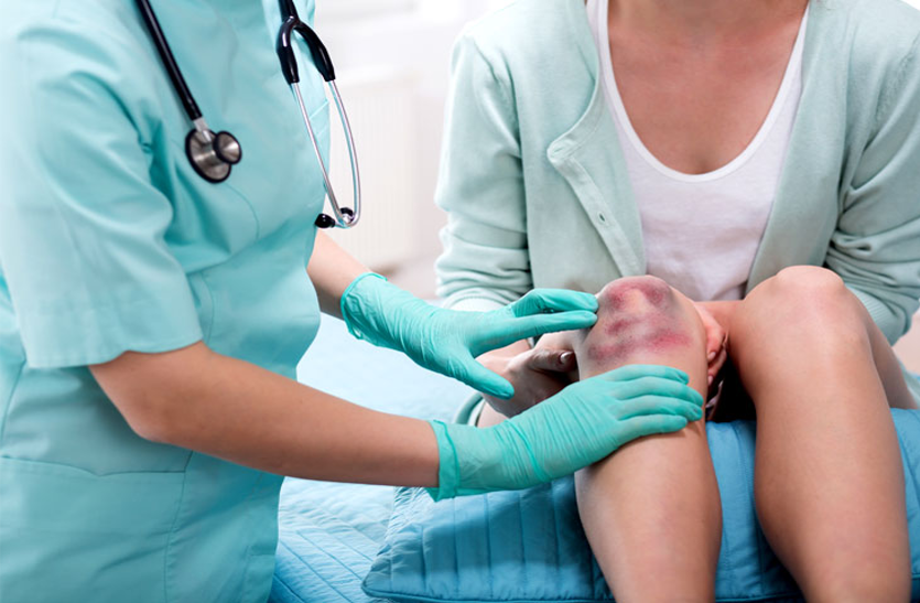 platelets-count-blue-rashes-on-body-causes-symptoms-and-treatment