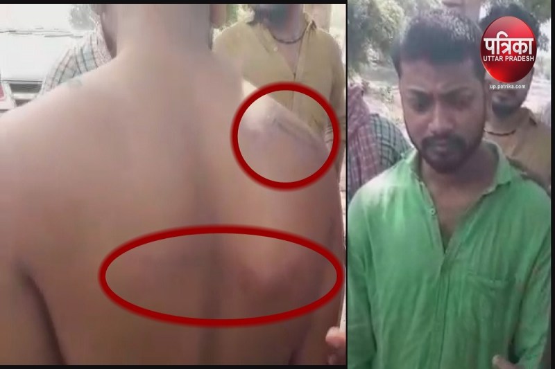 पुलिस की पिटाई से घायल युवक सन्नी पटेल