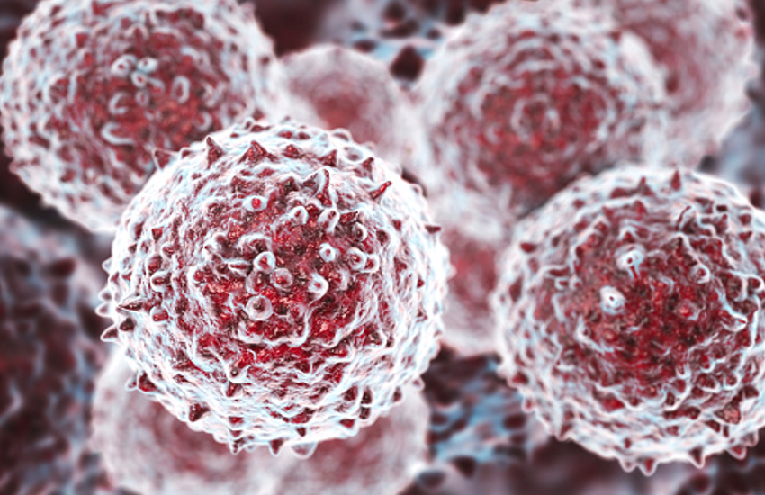 Leukemia