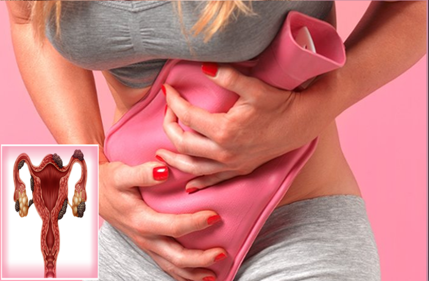 endometriosis-know-about-endometriosis-symptoms-causes-and-treatment