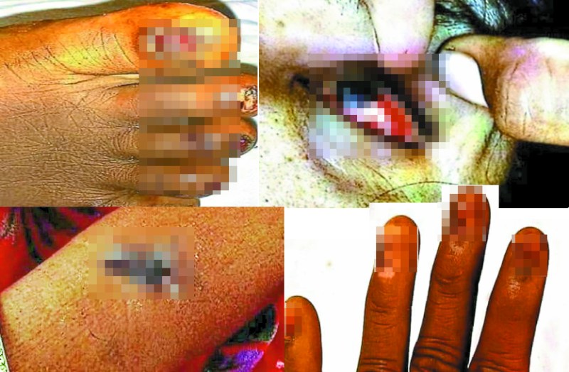 Churu Gang Rape in Police Station : राजस्थान के चूरू जिले के सरदारशहर में पुलिस की हैवानियत से भरी करतूत सामने आई है। यहां एक गरीब व लाचार महिला के साथ पुलिस ने कितनी बर्बरता की यह तस्वीरें हकीकत बयां कर रही है।