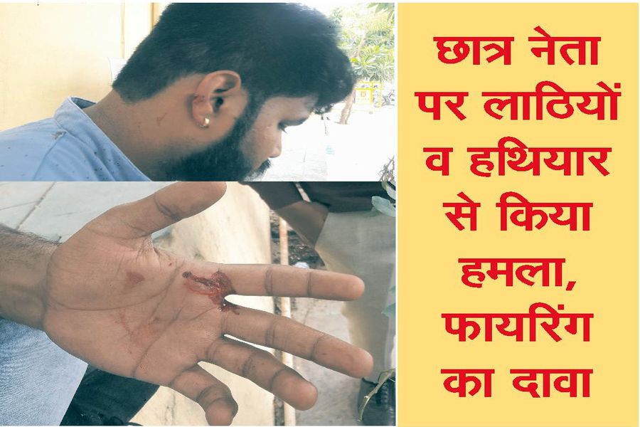 attack on student leader at kota commerce collage 
