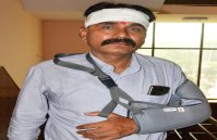 तू ज्यादा नेतागिरी कर रहा है और यह कहते हुए सिर पर दे मारा बेसबॉल का बल्ला