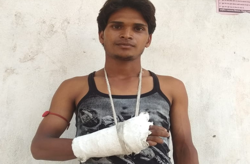 युवक का रास्ता रोककर मारपीट, हाथ-पांव तोड़ा, आठ हजार रुपए भी लूटा