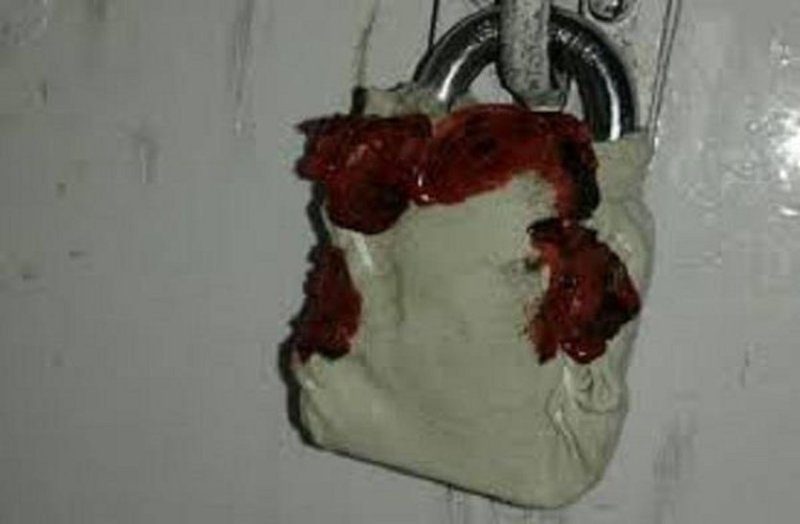 health department sealed clinics of three jholachap doctors