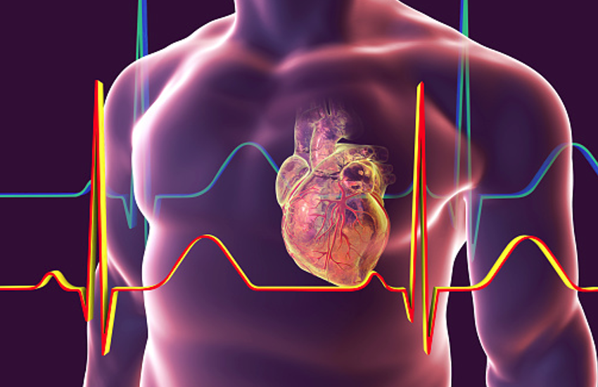 cardiac arrest