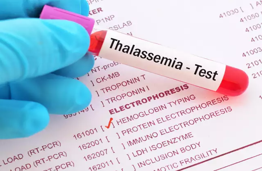 know-about-thalassemia