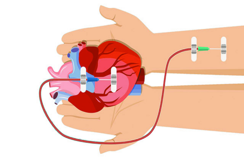 world organ donation