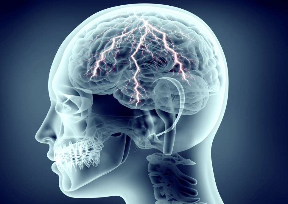 learn-about-the-causes-and-treatment-of-epilepsy