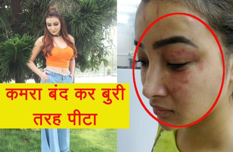 एक्ट्रेस संग हुई दिल दहला देने वाली घटना! रूममेट और उसकी मां ने बुरी तरह पीटा, बाद में कांच का ग्लास उठाया और...