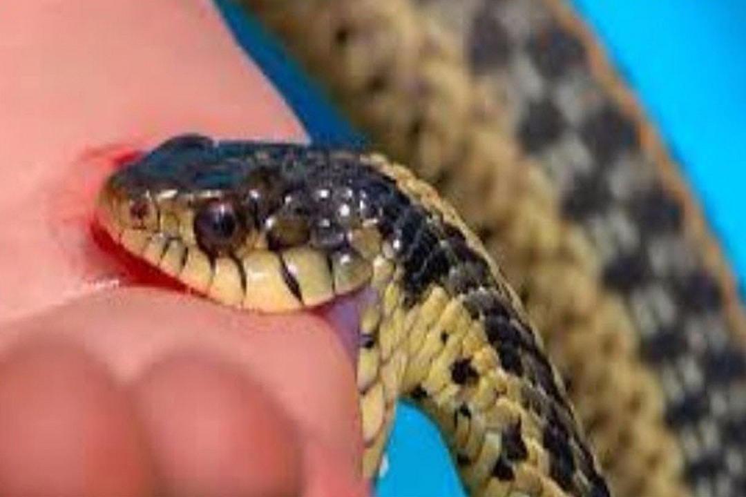 Snake bite