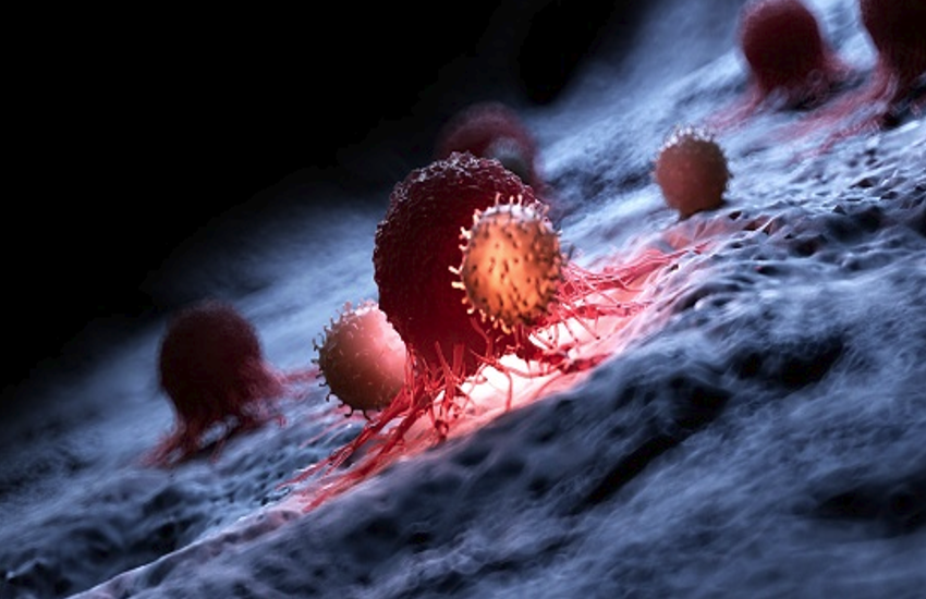 chronic myeloid leukemia - तेजी से फैलती हैं ब्लड कैंसर की कोशिकाएं