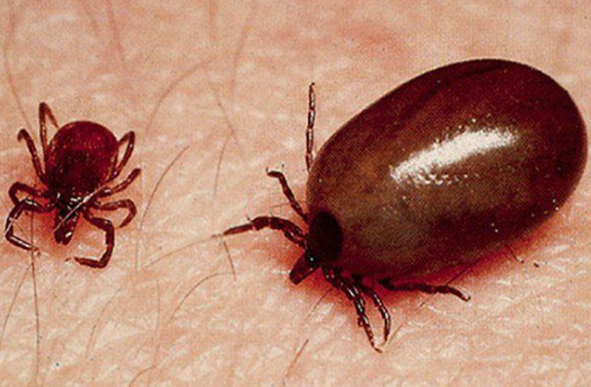 scrub typhus