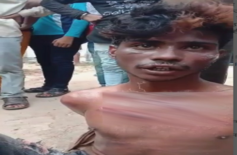 बाइक चोरी के आरोपी को लोगों ने पोल से बांधा, जमकर की बेरहमी से पिटाई, अस्पताल में भर्ती