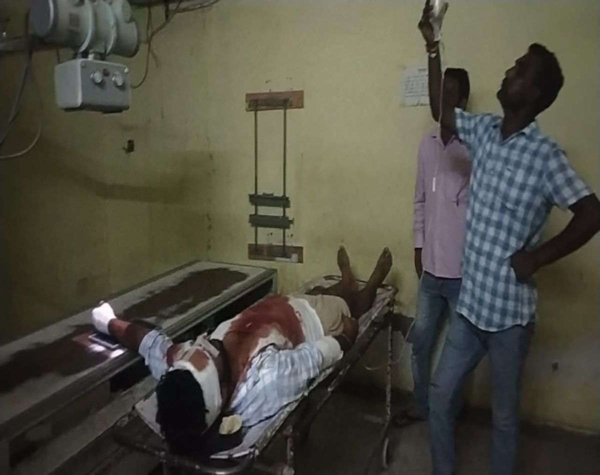 bikaner news : Employee injured while extinguishing fire in GSS