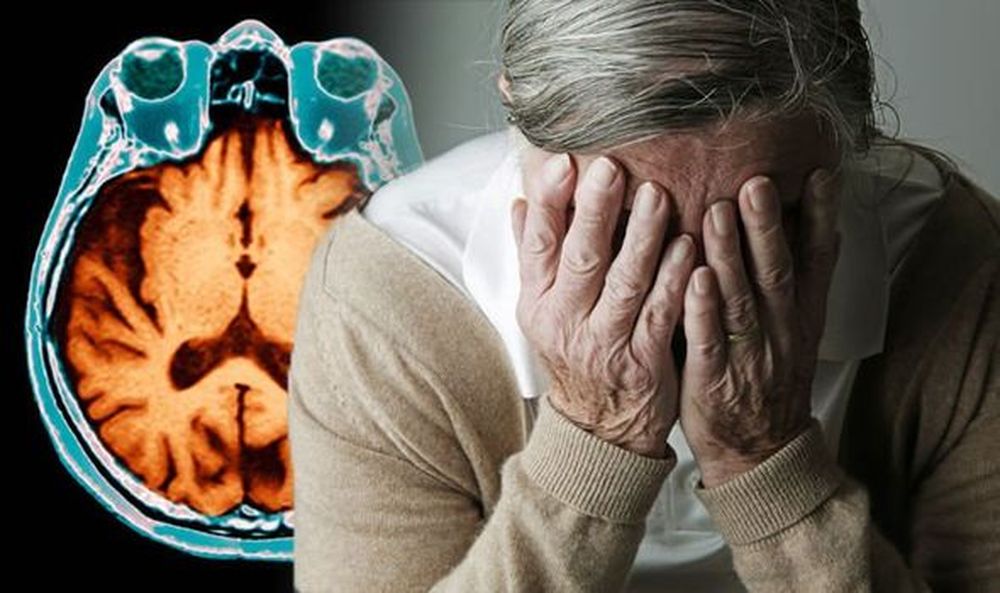 Alzheimer : 'अपनों' को भुला देता है अल्जाइमर, पर 'अपने' तो रखें याद