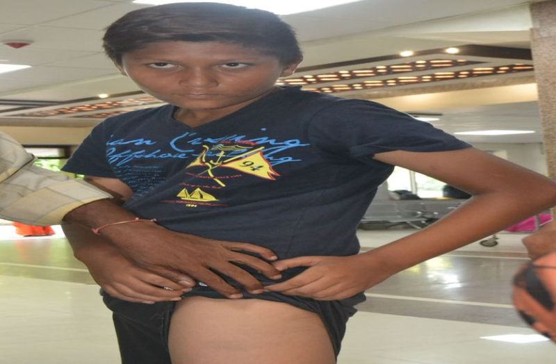 आठ दिन स्कूल नहीं गया तो शिक्षकों ने छात्र को पीटा