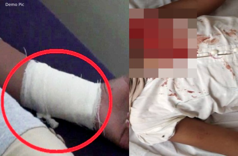 पढ़ाई के डर से 10 साल के दो भाइयों ने सीरियल देख रची खौफनाक कहानी, एक ने खुद को ब्लेड से काटा