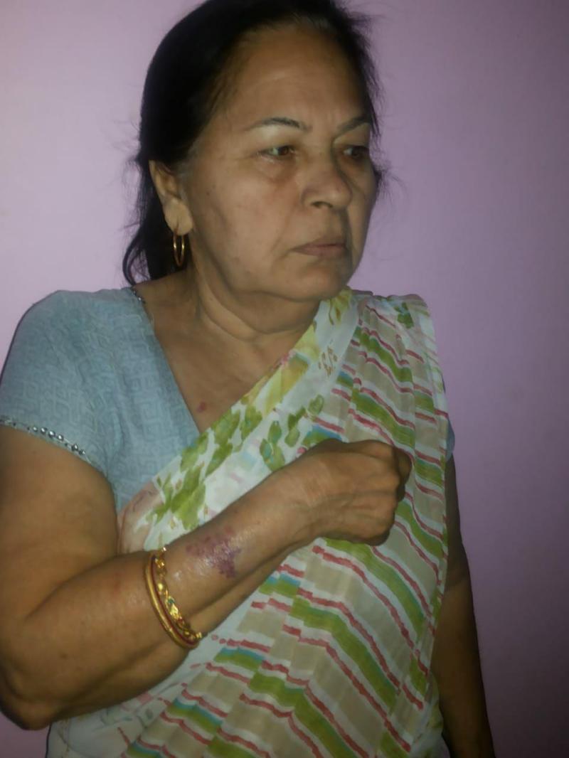 Elderly woman walks for a walk, bike riders run away by chain