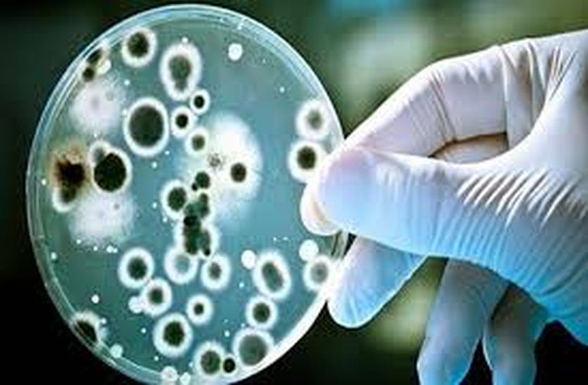 Brucellosis patients in bikaner
