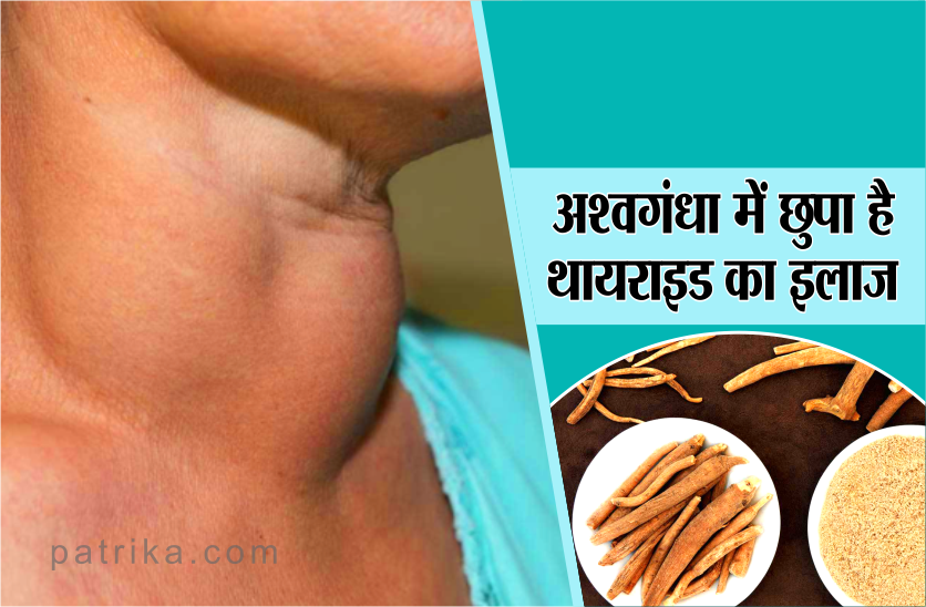 thyroid treatment ashvagandha