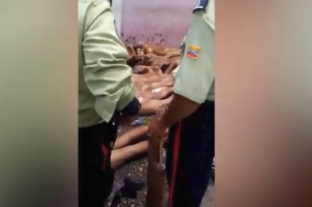 Venezuela prisoner tortured