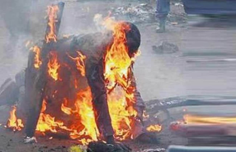 जिंदगी और मौत से जूझ रहा छोटा भाई, कहा- सोचा नहीं था एक मोबाइल के लिए मुझे जला देंगे भैया