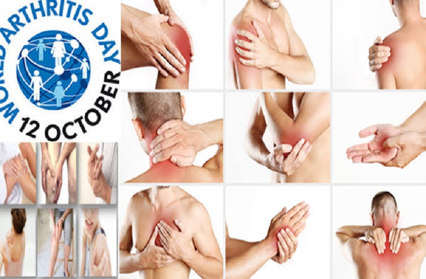 World Arthritis Day: जाने क्या है गठिया रोग, लक्षण और उपचार