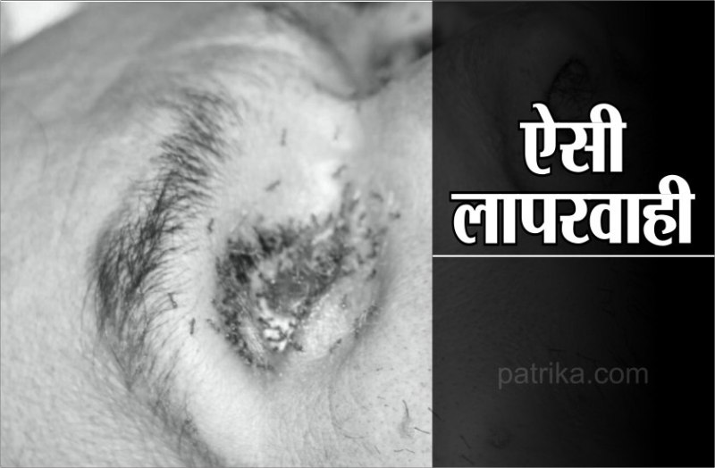 dead body lying on hospital for 5 hours ants crawling on the eye