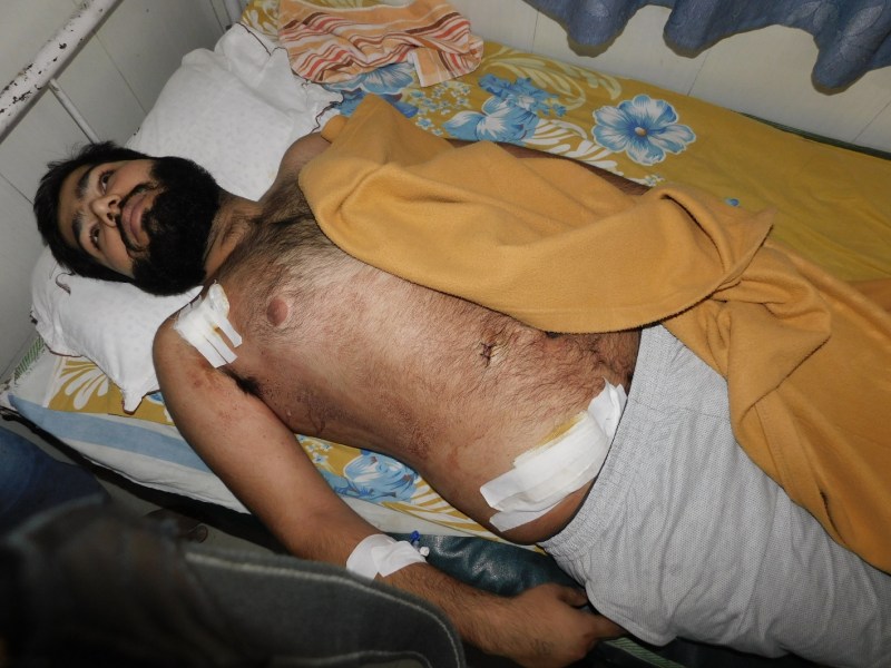 The accused kept wandering, attacking 3 people with knives in the nigh