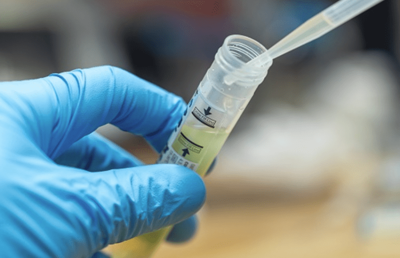 Urine infection can prevent the development of children