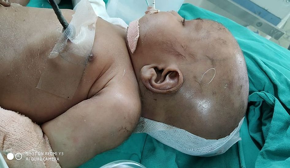 सोलह दिन की मासूम बच्ची को न्यू सिविल अस्पताल में मिली जिंदगी