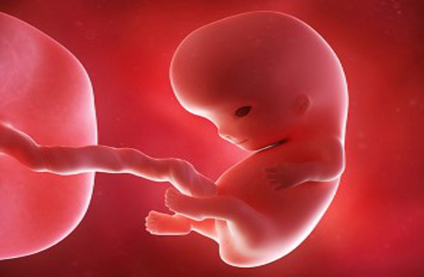 छह दिन की नवजात बच्ची की पेट में मिला भ्रूण, रिपोर्ट देखकर डॉक्टर और माता-पिता के उड़े होश