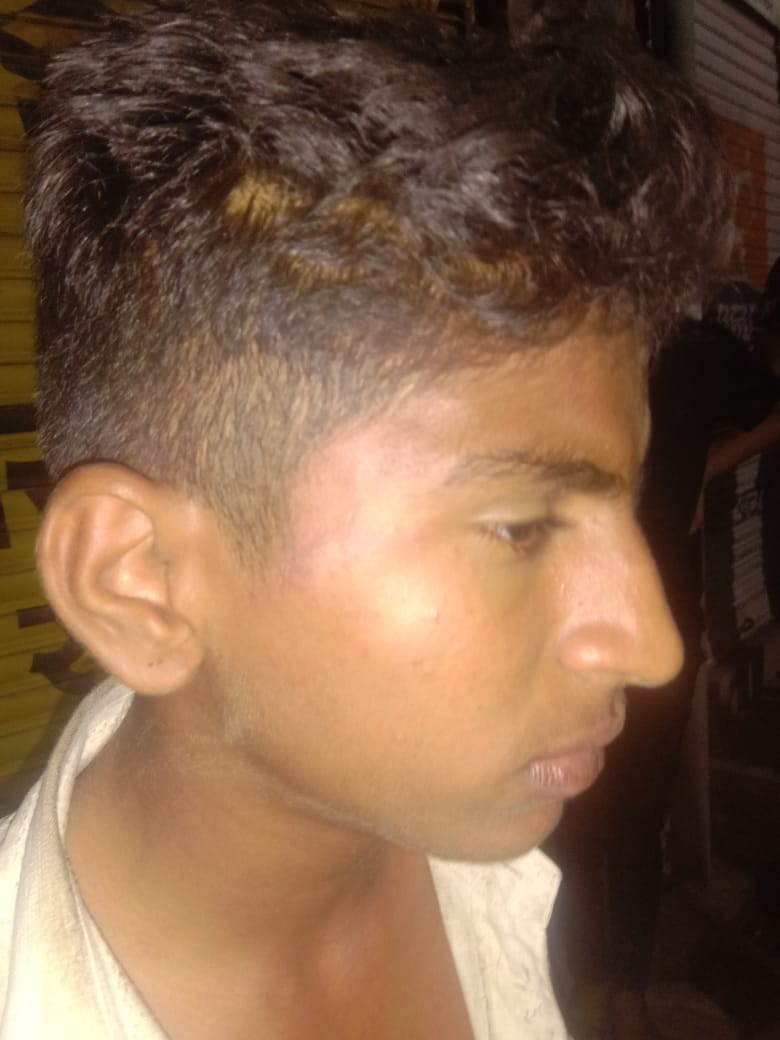 Attack on taking animals to Nandishala, three injured