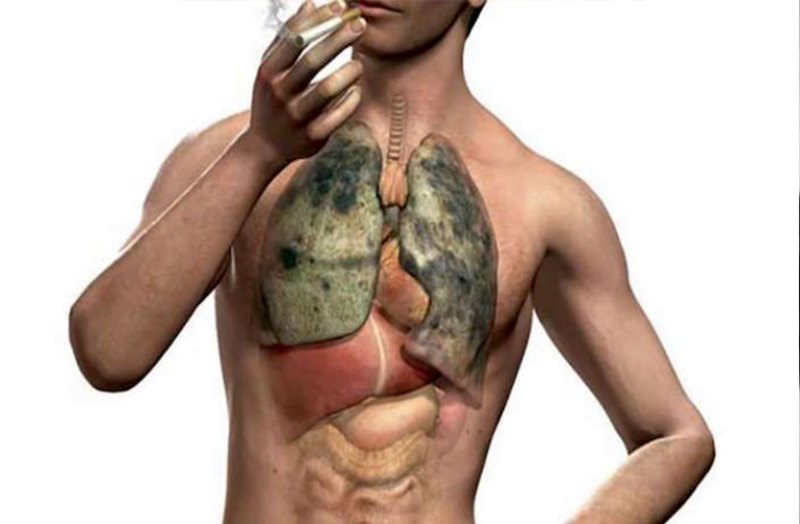 फेफड़ों के अलावा अन्य अंगों में भी हो सकती है टीबी