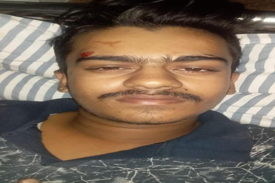 हाथ में मोबाइल ब्लास्ट होने से किशोर की हथेली फटी
