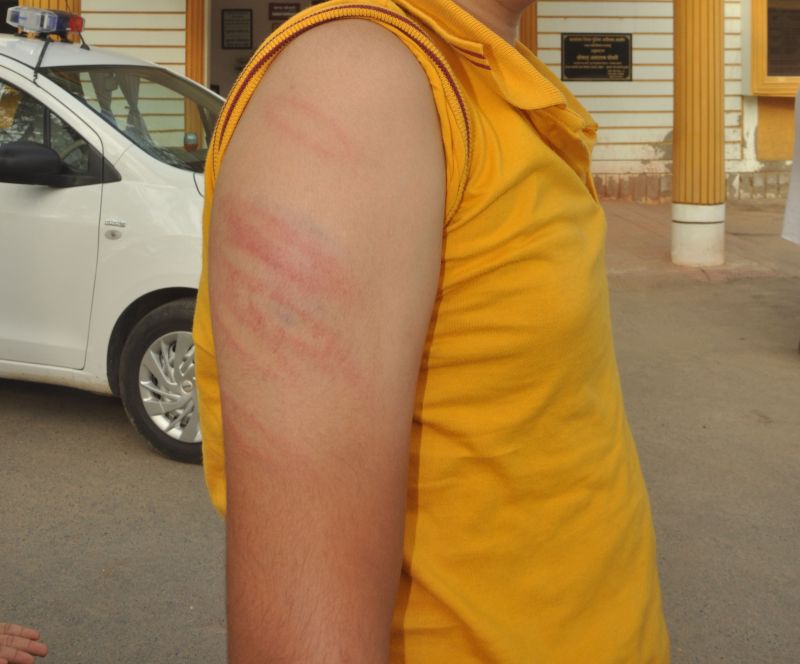 Innocent student beaten with iron pipe, injuries to hands and feet