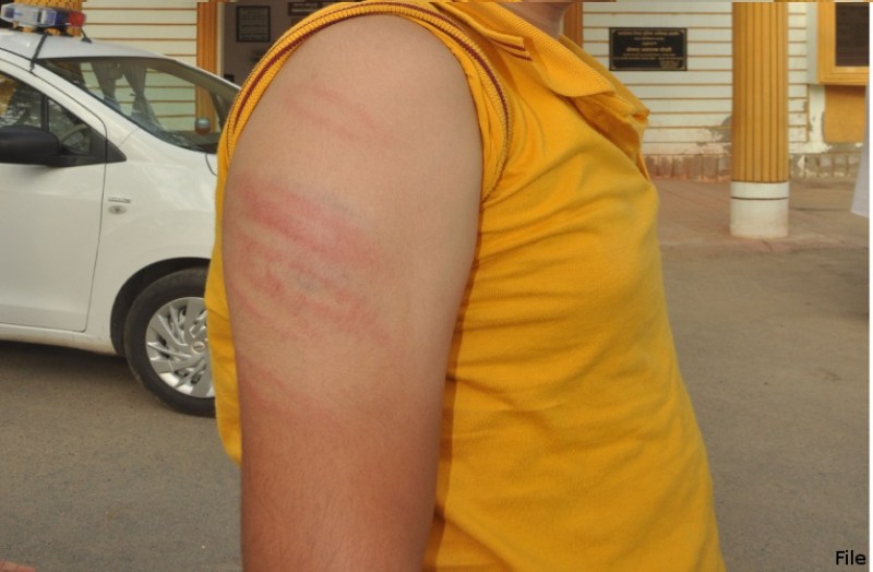 School responsibility, no student should be beaten