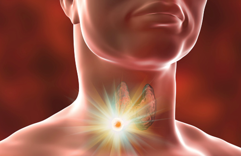 Throat Cancer: Risk factors, symptoms and treatments