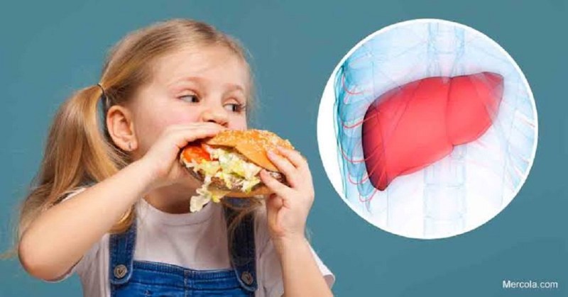 खानपान व नियमित जीवनशैली रखें ताकि बच्चों में न हो फैटी लिवर