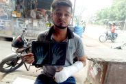 Homeguard jawan broke the young man's fingers.