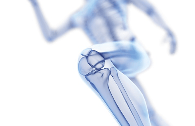 Over 250 cancer experts will discuss bone cancer