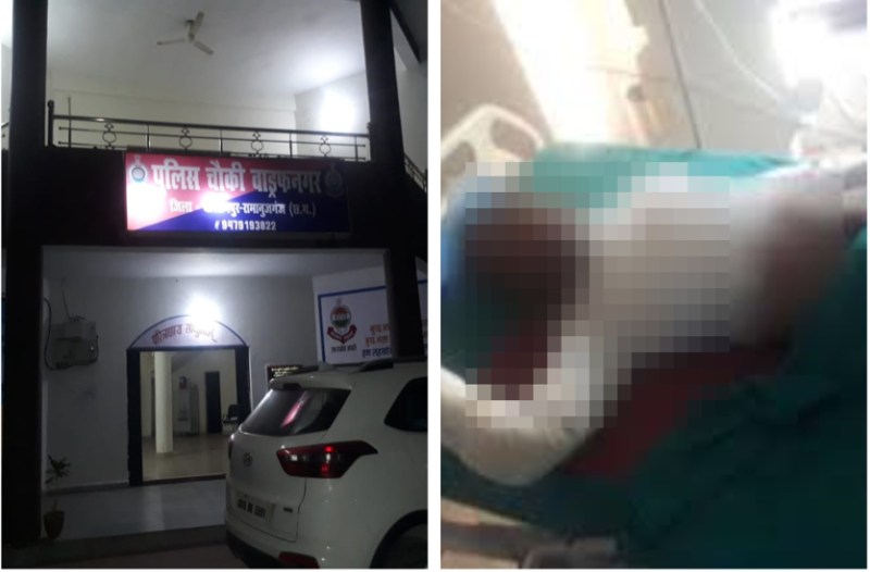 दूसरी पत्नी के साथ आरक्षक कमरे में पहुंचा तो वहां मौजूद थी पहली पत्नी, झगड़ा होने लगा तो खुद को जिंदा जलाया